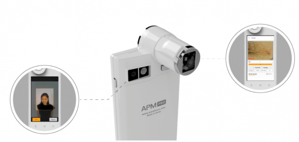 Ce fel de ten avem si care sunt cele mai frecvente probleme?!